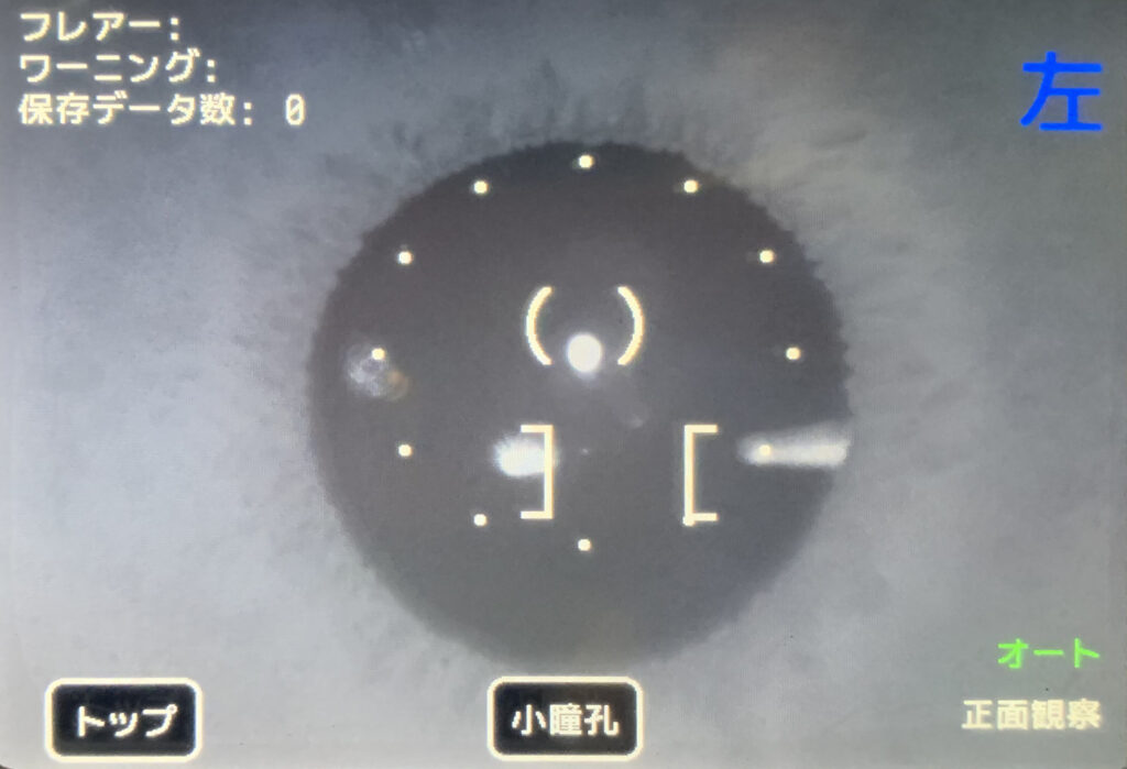 フレアメーターの撮影画像